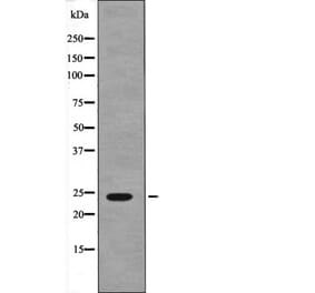 Western blot - NACA (Phospho-Ser43) Antibody from Signalway Antibody (12617) - Antibodies.com