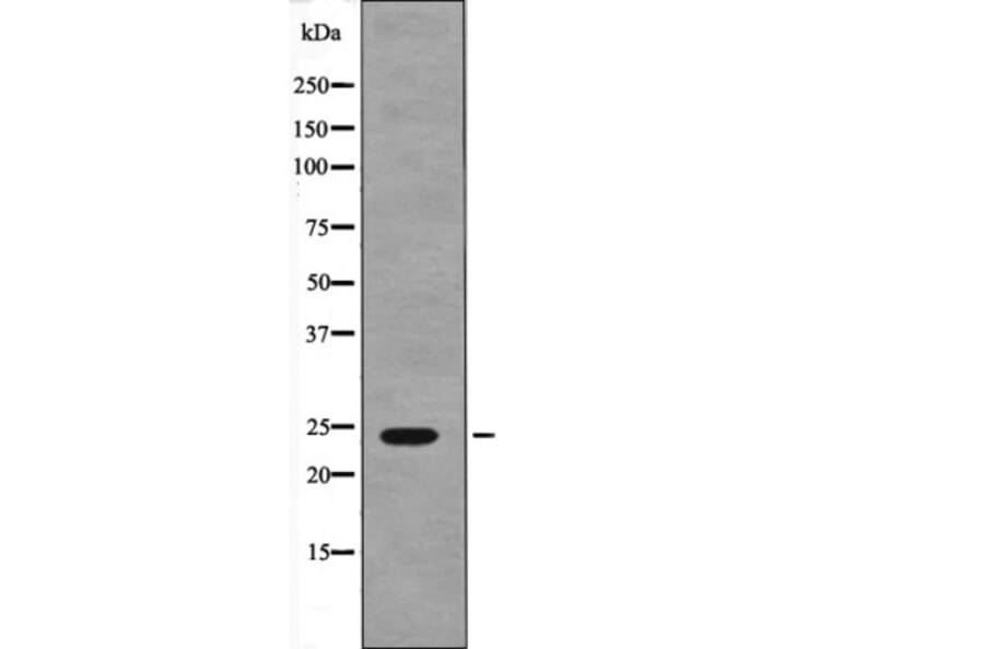 Western blot - NACA (Phospho-Ser43) Antibody from Signalway Antibody (12617) - Antibodies.com
