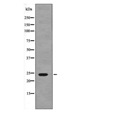 Western blot - NACA (Phospho-Ser43) Antibody from Signalway Antibody (12617) - Antibodies.com