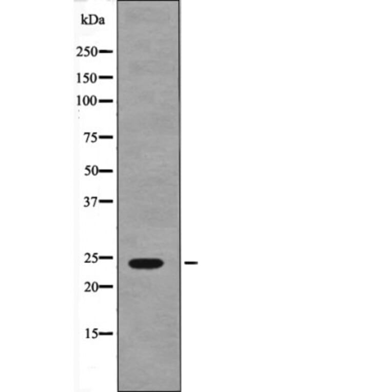 Western blot - NACA (Phospho-Ser43) Antibody from Signalway Antibody (12617) - Antibodies.com