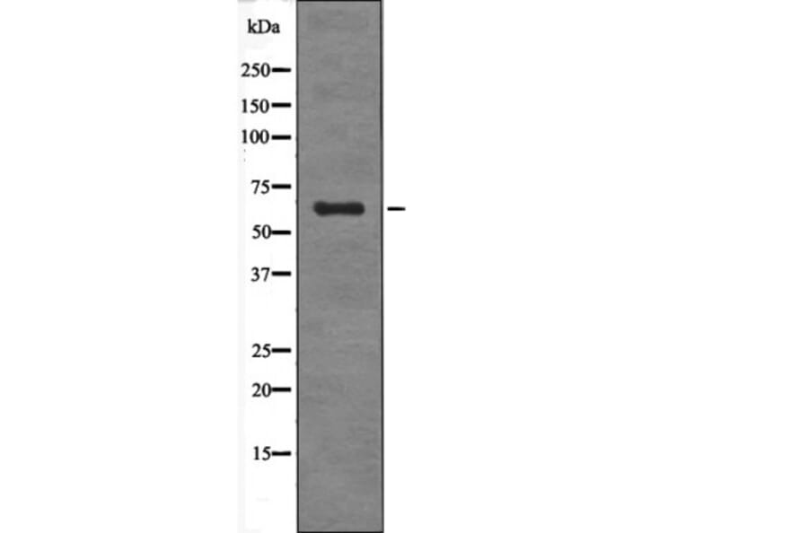 Western blot - SGO1 (Phospho-Ser14) Antibody from Signalway Antibody (12633) - Antibodies.com