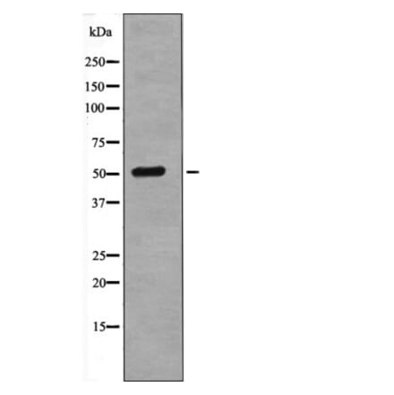 Western blot - Tel (Phospho-Ser257) Antibody from Signalway Antibody (12646) - Antibodies.com