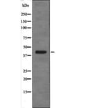 Western blot - XPA (Phospho-Ser196) Antibody from Signalway Antibody (12655) - Antibodies.com