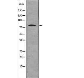 Western blot - BTK (Phospho-Ser179) Antibody from Signalway Antibody (12672) - Antibodies.com
