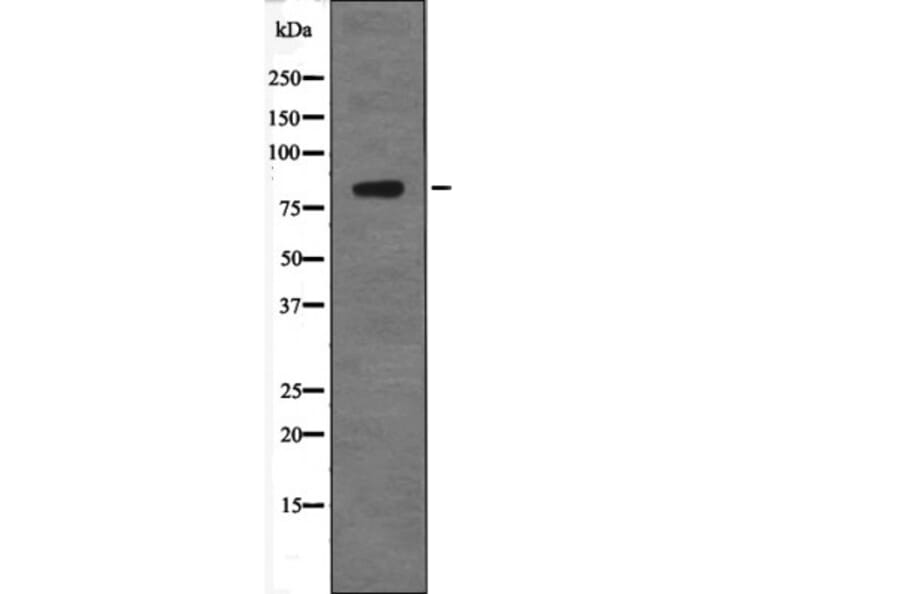 Western blot - GRK2 (Phospho-Tyr86) Antibody from Signalway Antibody (12684) - Antibodies.com