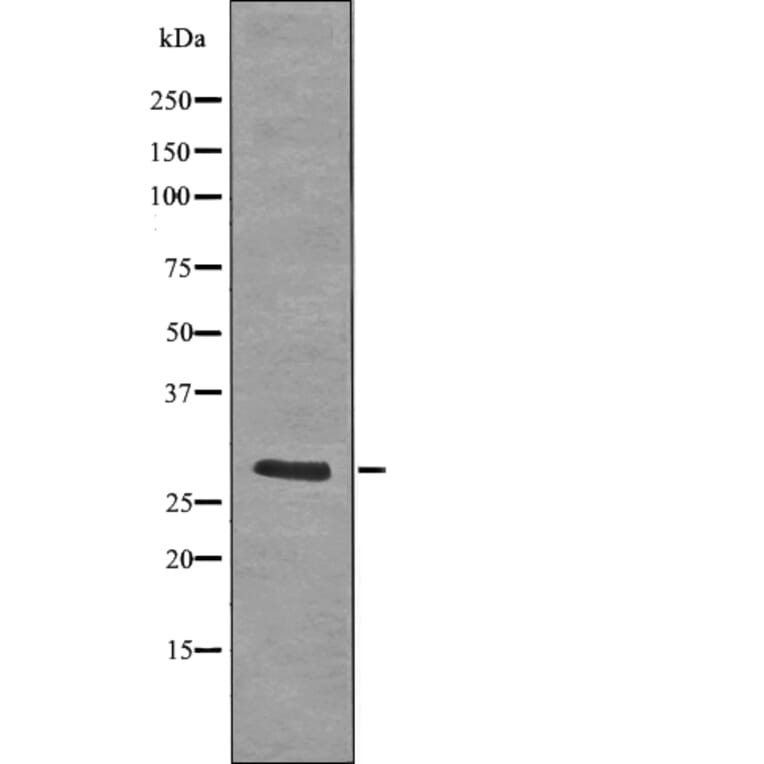 Western blot - LAT (Phospho-Tyr255) Antibody from Signalway Antibody (12728) - Antibodies.com