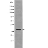 Western blot - LAT (Phospho-Tyr255) Antibody from Signalway Antibody (12728) - Antibodies.com