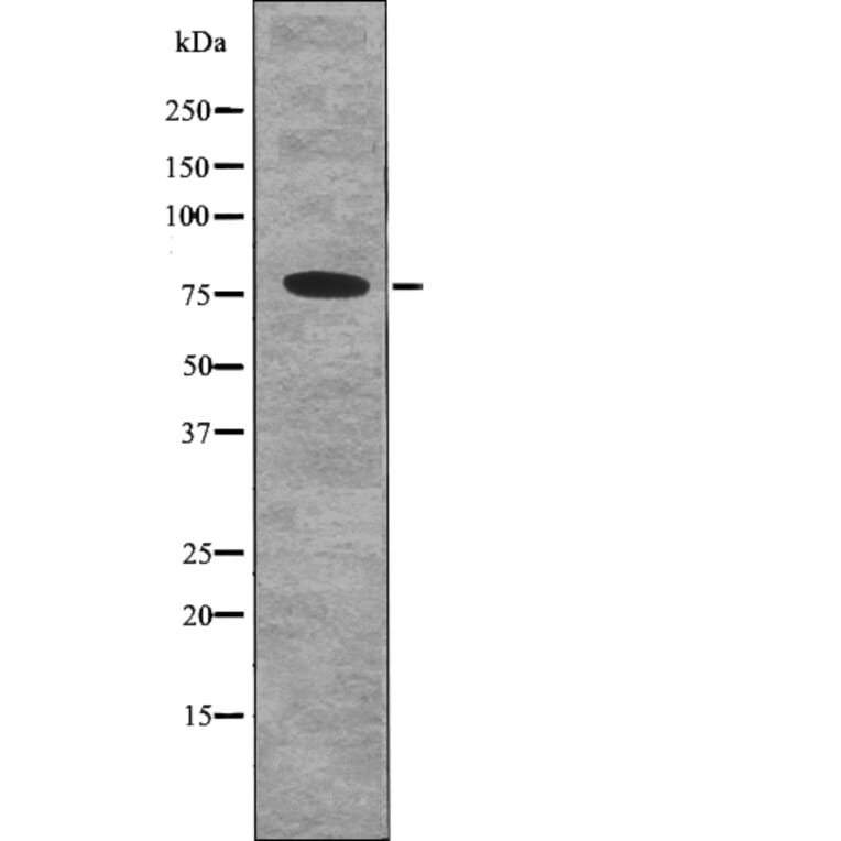 Western blot - p73 (Phospho-Ser388) Antibody from Signalway Antibody (12772) - Antibodies.com