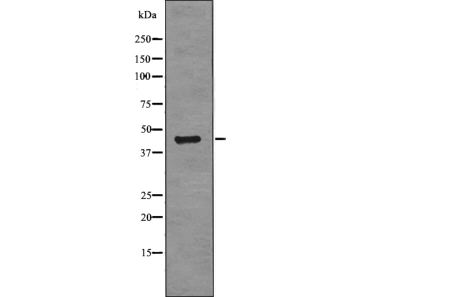 Western blot - RCC1 (Phospho-Ser11) Antibody from Signalway Antibody (12779) - Antibodies.com