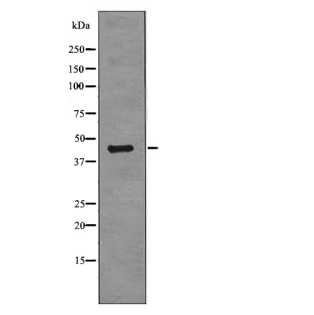 Western blot - RCC1 (Phospho-Ser11) Antibody from Signalway Antibody (12779) - Antibodies.com