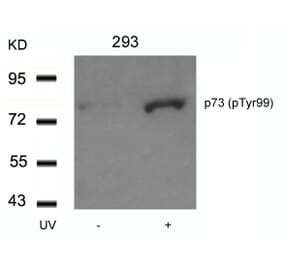 Western blot - p73 (Phospho-Tyr99) Antibody from Signalway Antibody (11058) - Antibodies.com