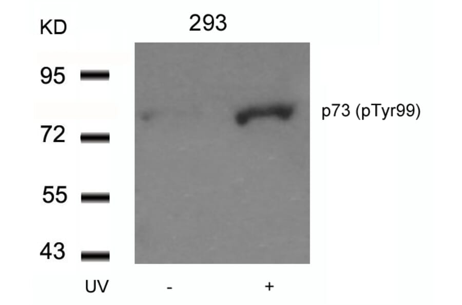 Western blot - p73 (Phospho-Tyr99) Antibody from Signalway Antibody (11058) - Antibodies.com