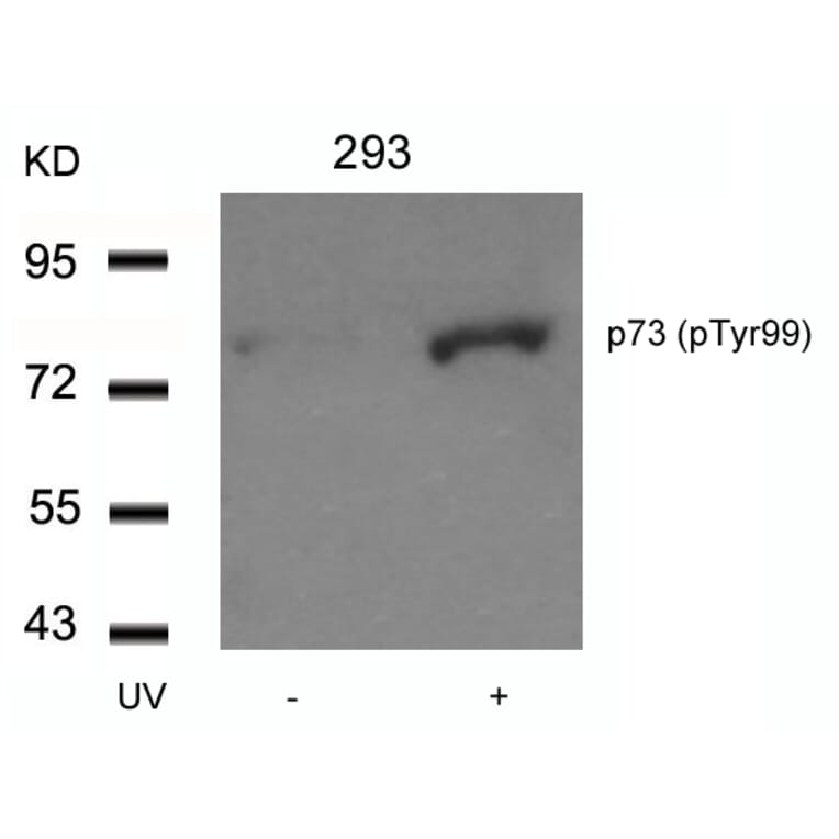 Western blot - p73 (Phospho-Tyr99) Antibody from Signalway Antibody (11058) - Antibodies.com
