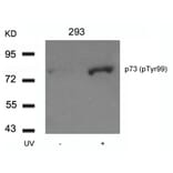Western blot - p73 (Phospho-Tyr99) Antibody from Signalway Antibody (11058) - Antibodies.com