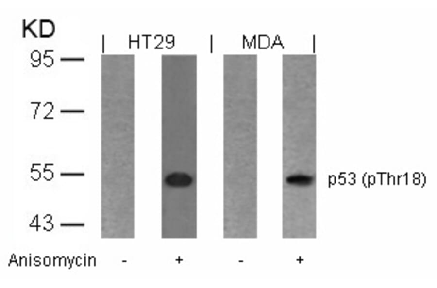 Western blot - p53 (Phospho-Thr18) Antibody from Signalway Antibody (11095) - Antibodies.com
