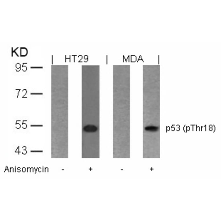 Western blot - p53 (Phospho-Thr18) Antibody from Signalway Antibody (11095) - Antibodies.com