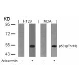Western blot - p53 (Phospho-Thr18) Antibody from Signalway Antibody (11095) - Antibodies.com