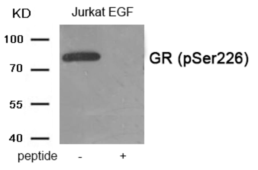 Western blot - GR (Phospho-Ser226) Antibody from Signalway Antibody (11937) - Antibodies.com