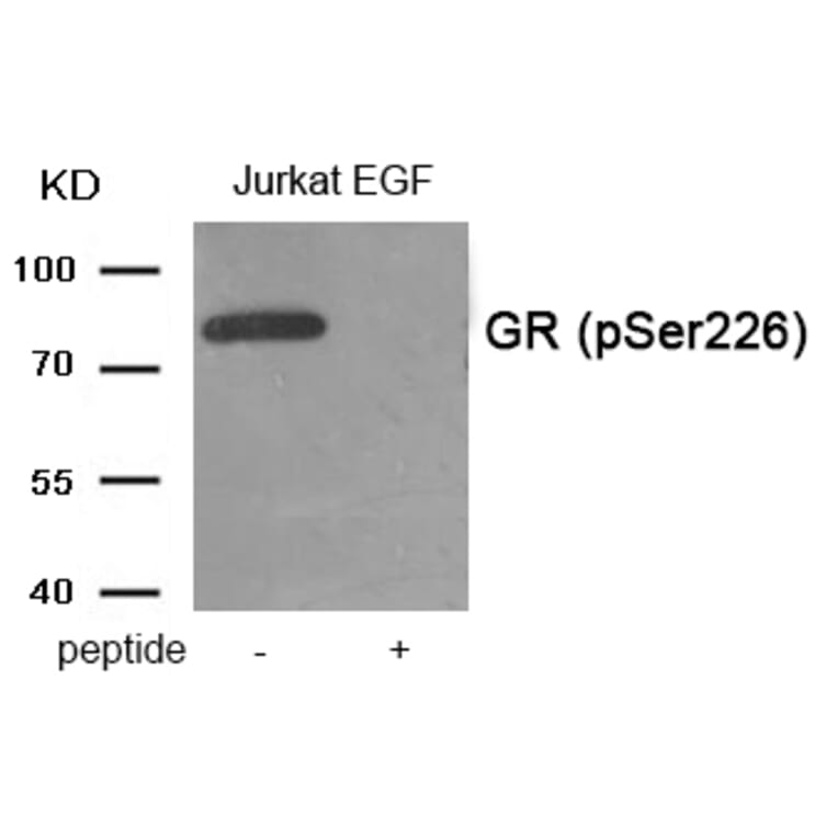 Western blot - GR (Phospho-Ser226) Antibody from Signalway Antibody (11937) - Antibodies.com