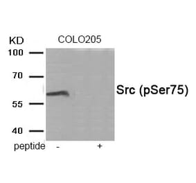 Western blot - Src (Phospho-Ser75) Antibody from Signalway Antibody (11944) - Antibodies.com