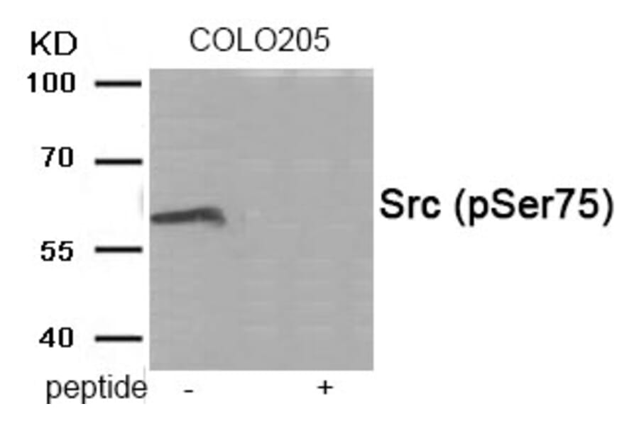 Western blot - Src (Phospho-Ser75) Antibody from Signalway Antibody (11944) - Antibodies.com