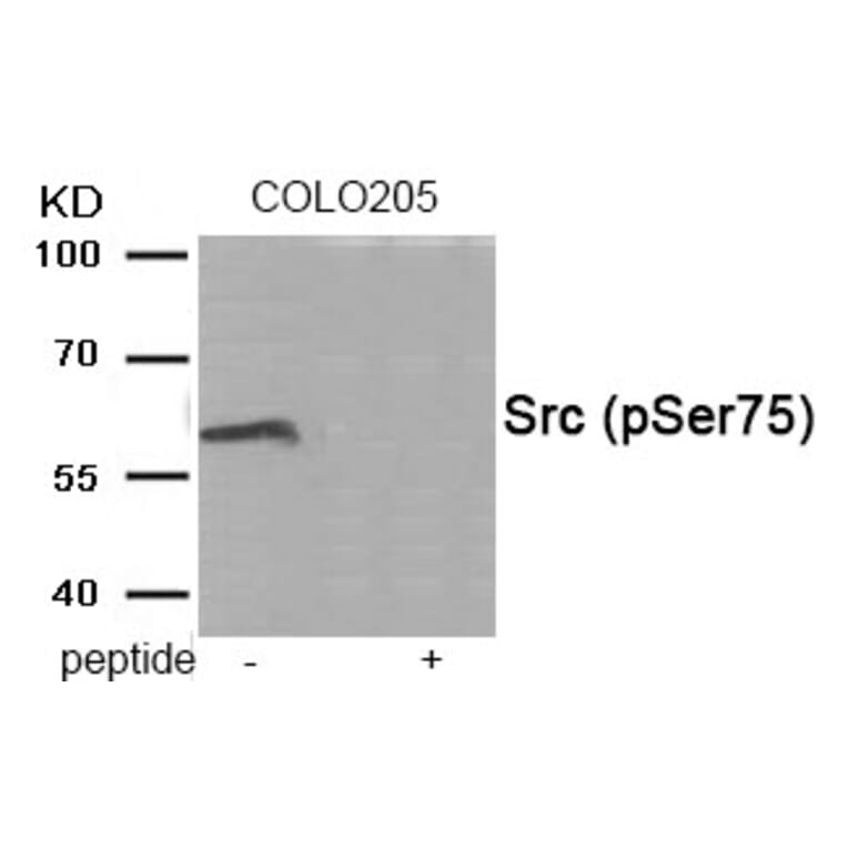 Western blot - Src (Phospho-Ser75) Antibody from Signalway Antibody (11944) - Antibodies.com