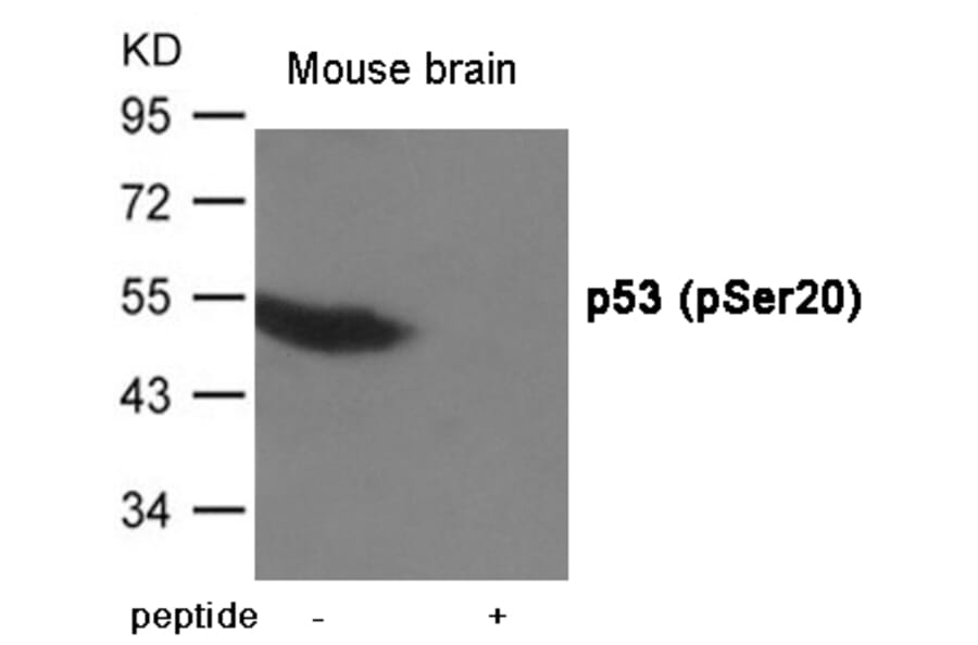 Western blot - p53 (Phospho-Ser20) Antibody from Signalway Antibody (12020) - Antibodies.com