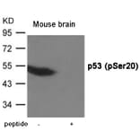 Western blot - p53 (Phospho-Ser20) Antibody from Signalway Antibody (12020) - Antibodies.com