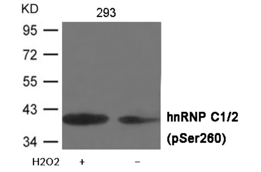 Western blot - hnRNP C1/2 (Phospho-Ser260) Antibody from Signalway Antibody (12048) - Antibodies.com