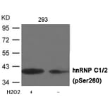 Western blot - hnRNP C1/2 (Phospho-Ser260) Antibody from Signalway Antibody (12048) - Antibodies.com