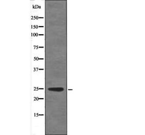 Western blot - VHL (Phospho-Ser68) Antibody from Signalway Antibody (12654) - Antibodies.com