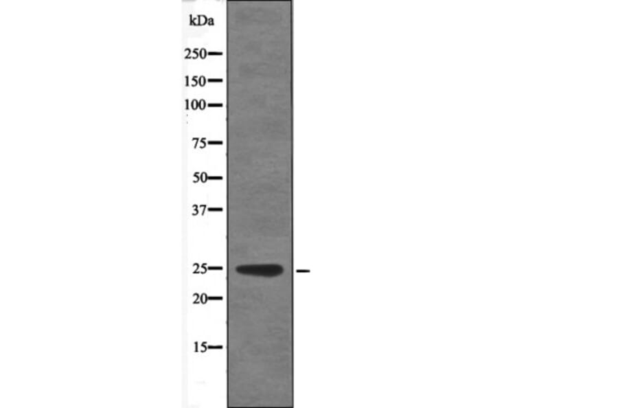 Western blot - VHL (Phospho-Ser68) Antibody from Signalway Antibody (12654) - Antibodies.com