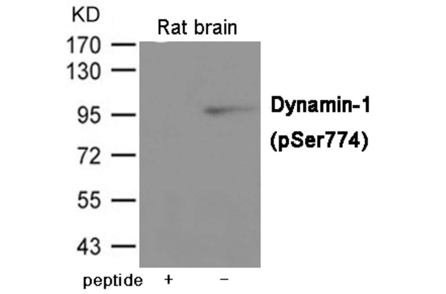Western blot - Dynamin-1 (Phospho-Ser774) Antibody from Signalway Antibody (12005) - Antibodies.com