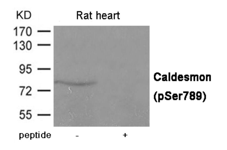 Western blot - Caldesmon (Phospho-Ser789) Antibody from Signalway Antibody (12012) - Antibodies.com