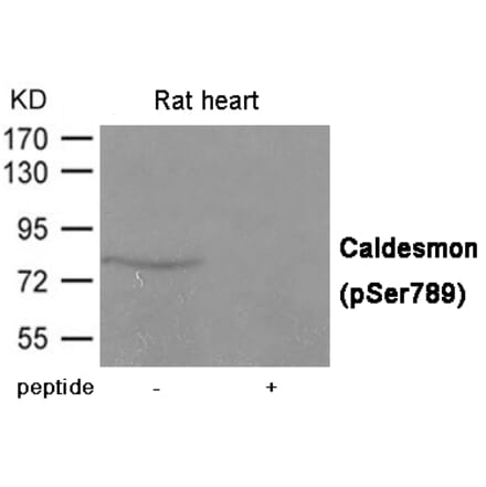 Western blot - Caldesmon (Phospho-Ser789) Antibody from Signalway Antibody (12012) - Antibodies.com