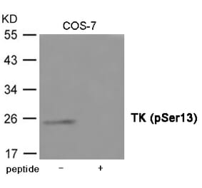 Western blot - TK (Phospho-Ser13) Antibody from Signalway Antibody (12027) - Antibodies.com