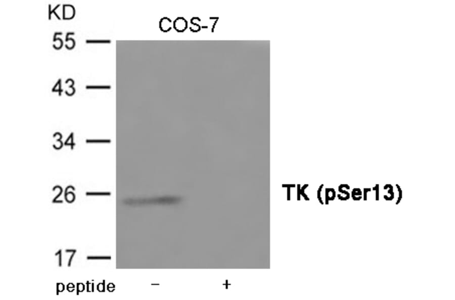 Western blot - TK (Phospho-Ser13) Antibody from Signalway Antibody (12027) - Antibodies.com