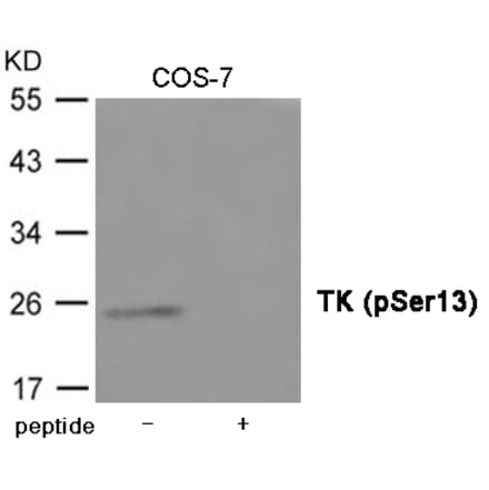 Western blot - TK (Phospho-Ser13) Antibody from Signalway Antibody (12027) - Antibodies.com