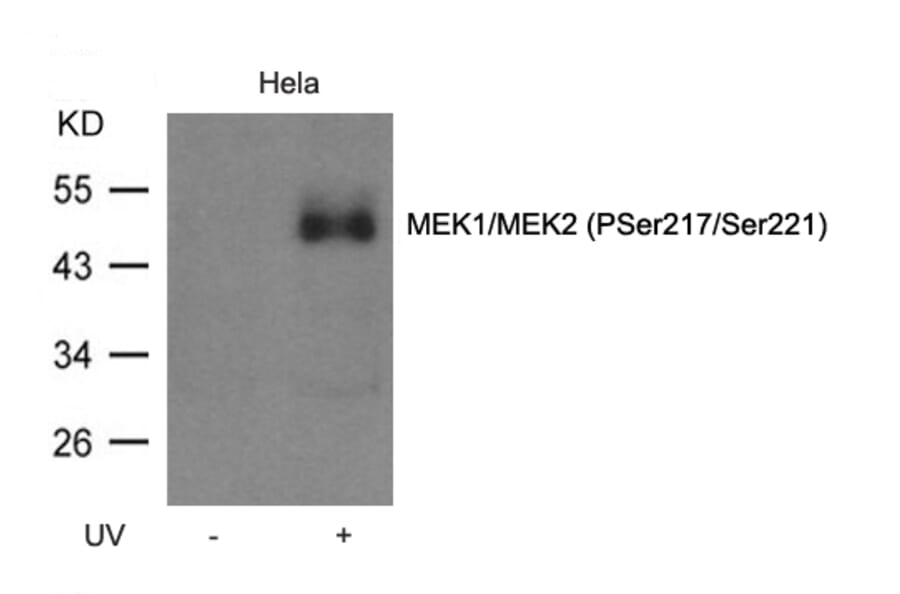 Western blot - MEK1/MEK2 (Phospho-Ser217/Ser221) Antibody from Signalway Antibody (11205) - Antibodies.com