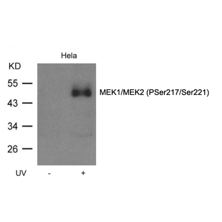 Western blot - MEK1/MEK2 (Phospho-Ser217/Ser221) Antibody from Signalway Antibody (11205) - Antibodies.com