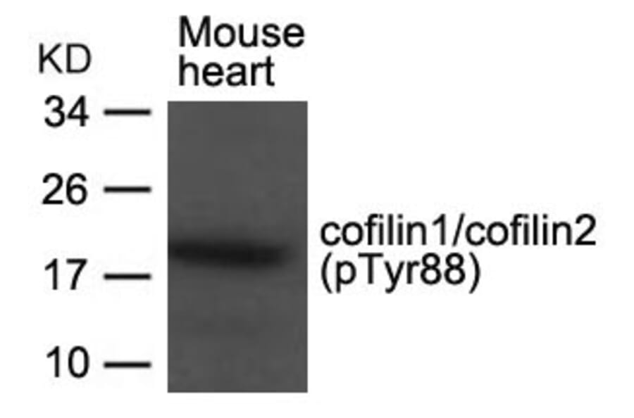 Western blot - cofilin1/cofilin2 (phospho-Tyr88) Antibody from Signalway Antibody (11507) - Antibodies.com