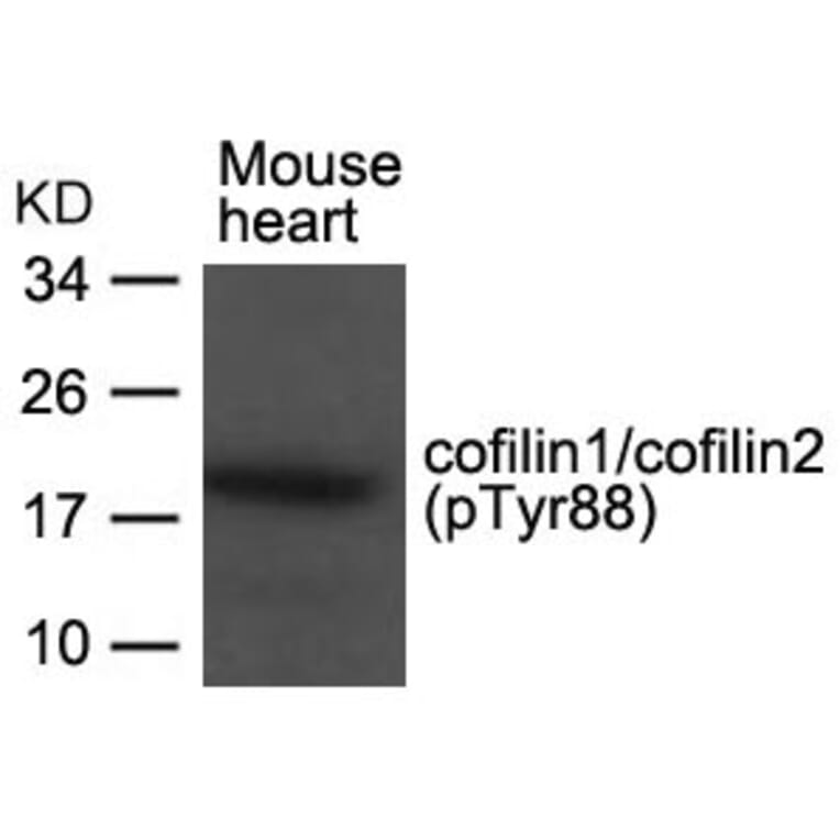 Western blot - cofilin1/cofilin2 (phospho-Tyr88) Antibody from Signalway Antibody (11507) - Antibodies.com