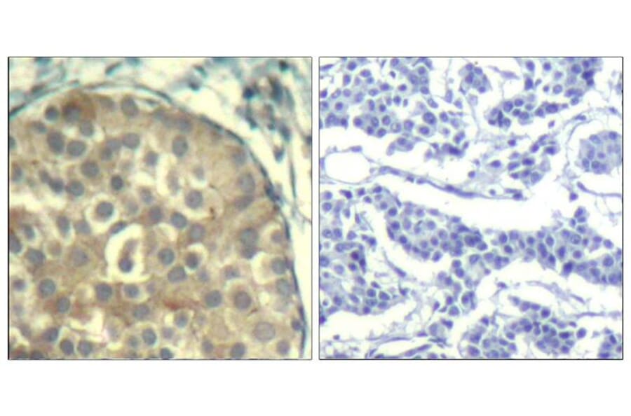 Immunohistochemistry - cofilin1/cofilin2 (phospho-Tyr88) Antibody from Signalway Antibody (11507) - Antibodies.com