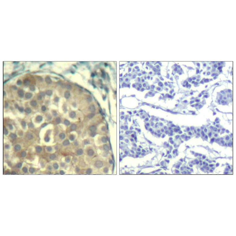 Immunohistochemistry - cofilin1/cofilin2 (phospho-Tyr88) Antibody from Signalway Antibody (11507) - Antibodies.com