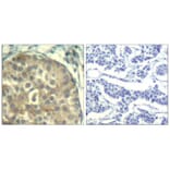 Immunohistochemistry - cofilin1/cofilin2 (phospho-Tyr88) Antibody from Signalway Antibody (11507) - Antibodies.com