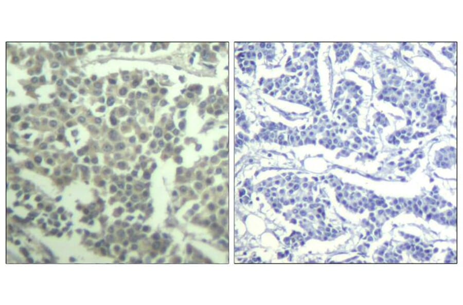 Immunohistochemistry - c-kit (phospho-Tyr936) Antibody from Signalway Antibody (11539) - Antibodies.com