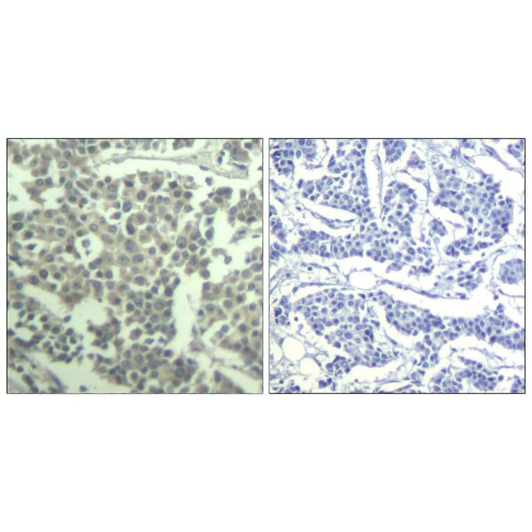 Immunohistochemistry - c-kit (phospho-Tyr936) Antibody from Signalway Antibody (11539) - Antibodies.com