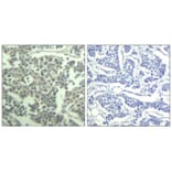 Immunohistochemistry - c-kit (phospho-Tyr936) Antibody from Signalway Antibody (11539) - Antibodies.com