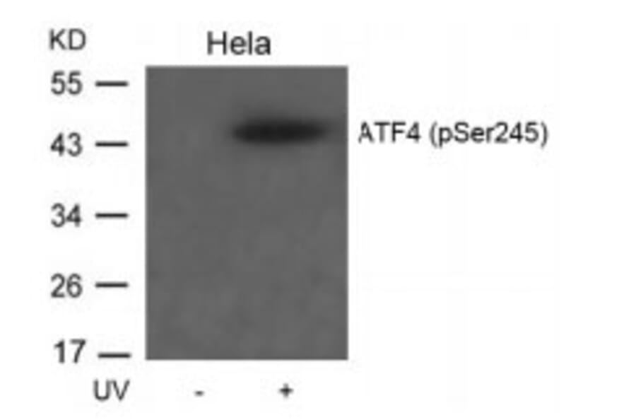 Western blot - ATF4 (Phospho-Ser245) Antibody from Signalway Antibody (11053) - Antibodies.com