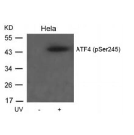 Western blot - ATF4 (Phospho-Ser245) Antibody from Signalway Antibody (11053) - Antibodies.com